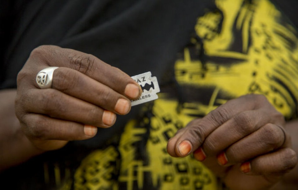 A circumciser showing the razor used in the FGM procedure | Photo: UNFPA  