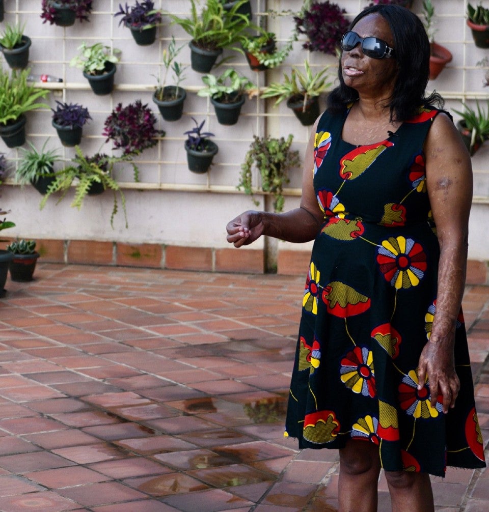  Judith Agole, a survivor of acid attack violence speaks to UN Women Uganda during a video interview conducted for 16 Days of Activism. Photo: UN Women Uganda/Eva Sibanda